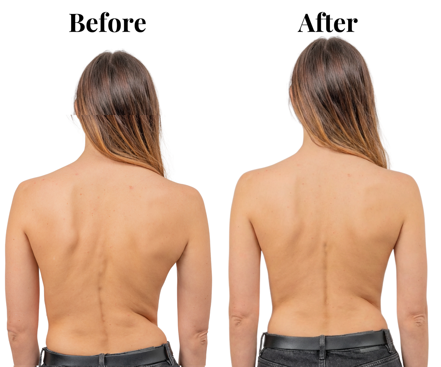 Axi-Ora™  Instant Posture Corrector