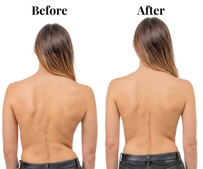 Axi-Ora™  Instant Posture Corrector